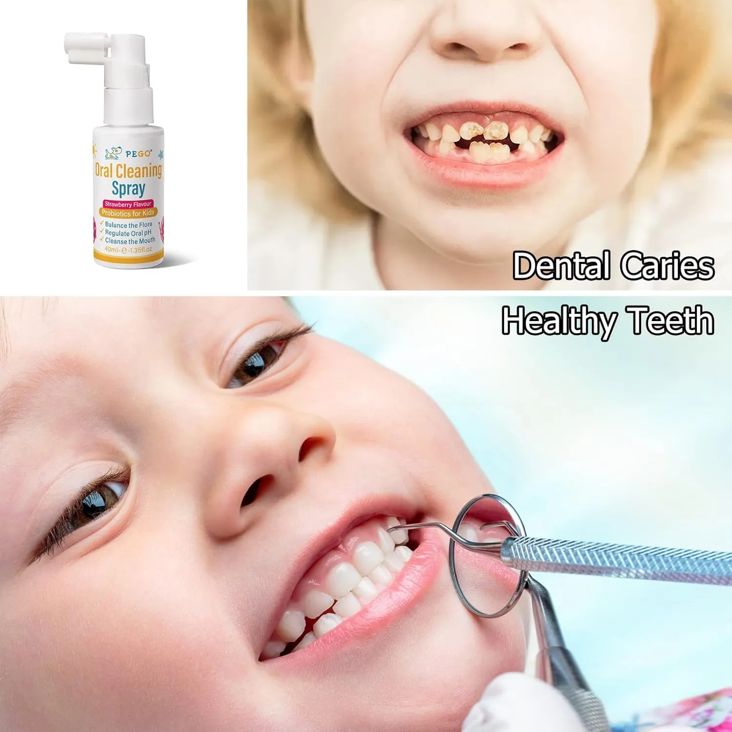 PEGO Kids Oral Spray, Toddler Toothpaste Helper for Cavity Prevention and Fresh Breath, Children Anticavity with Fluoride Free for Newborn to Preschoolers, Kid's Mouth Spray (40ml*1/Pcs)