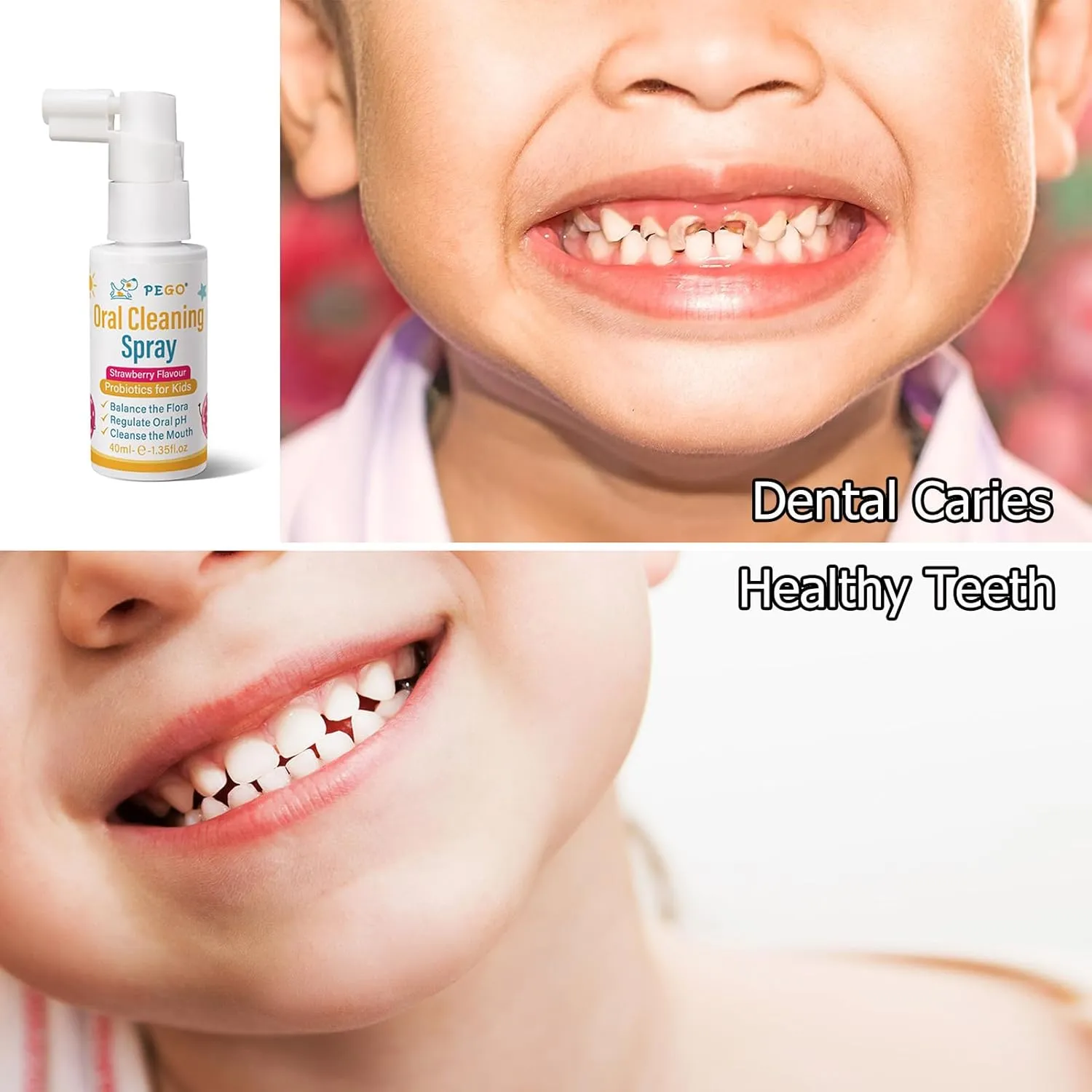 PEGO Kids Oral Spray, Toddler Toothpaste Helper for Cavity Prevention and Fresh Breath, Children Anticavity with Fluoride Free for Newborn to Preschoolers, Kid's Mouth Spray (40ml*1/Pcs)